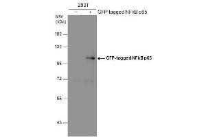 WB Image Non-transfected (–) and transfected (+) 293T whole cell extracts (30 μg) were separated by 7. (NF-kB p65 抗体  (Center))