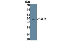Detection of Recombinant ANGPTL8, Human using Monoclonal Antibody to Angiopoietin Like Protein 8 (ANGPTL8) (C19ORF80 抗体  (AA 24-196))