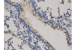 Immunohistochemistry (IHC) image for anti-Carcinoembryonic Antigen-Related Cell Adhesion Molecule 3 (CEACAM3) antibody (ABIN1871781) (CEACAM3 抗体)