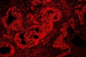 IF analysis of nmt55/p54nrbusing anti-nmt55/p54nrb antibody (ABIN3044530). (NONO 抗体  (N-Term))