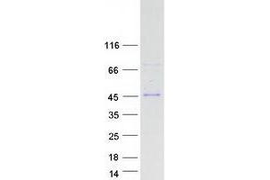 Western Blotting (WB) image for Kinetochore-associated protein DSN1 homolog (DSN1) (Transcript Variant 3) protein (Myc-DYKDDDDK Tag) (ABIN2719770)