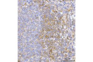 IHC analysis of Hamartin/TSC1 using anti-Hamartin/TSC1 antibody (ABIN7599499). (TSC1 抗体  (AA 1-618))