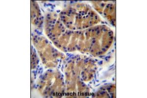 IL17B Antibody (Center) (ABIN655941 and ABIN2845330) immunohistochemistry analysis in formalin fixed and paraffin embedded human stomach tissue followed by peroxidase conjugation of the secondary antibody and DAB staining. (IL17B 抗体  (AA 39-66))