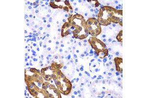 Immunohistochemistry of paraffin-embedded rat kidney using KRT19 antibody. (Cytokeratin 19 抗体)