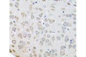 Immunohistochemistry of paraffin-embedded Mouse brain using Polyclonal AntibodyPC4 Polyclonal Antibody at dilution of 1:100 (40x lens). (SUB1 抗体)