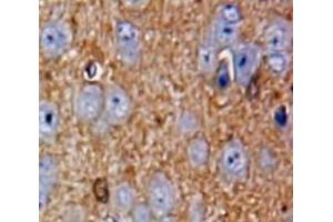 IHC-P analysis of Brain tissue, with DAB staining. (CILP 抗体  (AA 604-864))