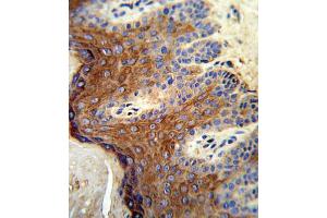 Immunohistochemistry (IHC) image for anti-Arachidonate 12-Lipoxygenase (ALOX12) antibody (ABIN3003946) (ALOX12 抗体)