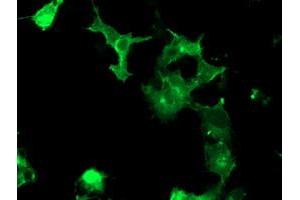 Image no. 2 for anti-PTK7 Protein tyrosine Kinase 7 (PTK7) antibody (ABIN1497127) (PTK7 抗体)