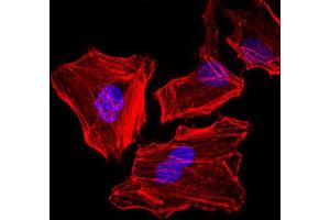 Immunofluorescence analysis of HeLa cells. (Cytokeratin 5 抗体)