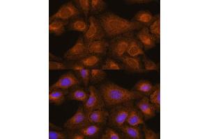 Immunofluorescence analysis of U-2 OS cells using [KO] GIT1 antibody (ABIN7267383) at dilution of 1:100. (GIT1 抗体  (AA 460-640))