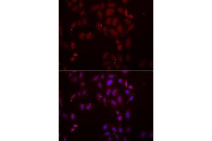 Immunofluorescence analysis of A549 cells using FRZB antibody (ABIN5973961). (FRZB 抗体)