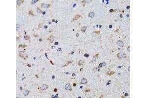 Immunohistochemistry of paraffin-embedded Mouse brain using TNFSF12 Polyclonal Antibody at dilution of 1:100 (40x lens). (TWEAK 抗体)