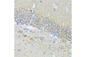 Immunohistochemistry of paraffin-embedded mouse brain using CASP3 antibody. (Caspase 3 抗体)
