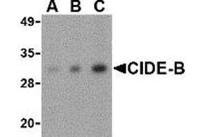 Western Blotting (WB) image for anti-Cell Death-Inducing DFFA-Like Effector B (CIDEB) (Middle Region) antibody (ABIN1030906) (CIDEB 抗体  (Middle Region))