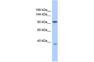 WB Suggested Anti-AP2B1 Antibody Titration: 0. (AP2B1 抗体  (Middle Region))