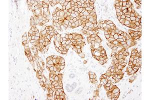 Immunohistochemistry (IHC) image for anti-Receptor tyrosine-protein kinase erbB-2 (ErbB2/Her2) (C-Term) antibody (ABIN7448962)