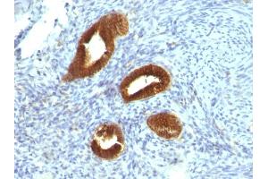 Immunohistochemistry (IHC) image for anti-Keratin 19 (KRT19) antibody (ABIN6939946)