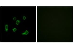 Immunofluorescence analysis of HuvEc cells, using ATG4C Antibody.