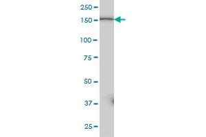 PIK3C2B monoclonal antibody (M02A), clone 3E5 Western Blot analysis of PIK3C2B expression in A-431 .