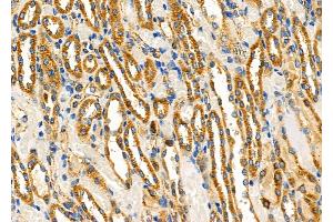 ABIN6262388 and ABIN6266563 at 1/100 staining Rat kidney tissue by IHC-P. (HSPE1 抗体  (Internal Region))