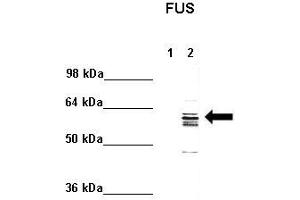 Western Blotting (WB) image for anti-Fused in Sarcoma (FUS) (N-Term) antibody (ABIN2778717)