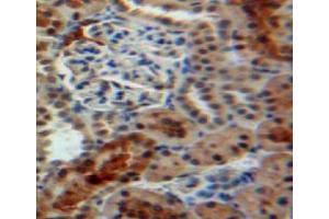 IHC-P analysis of kidney tissue, with DAB staining. (PPIB 抗体  (AA 34-216))