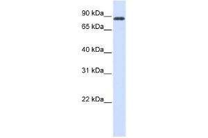HECTD2 antibody used at 1 ug/ml to detect target protein. (HECTD2 抗体  (C-Term))