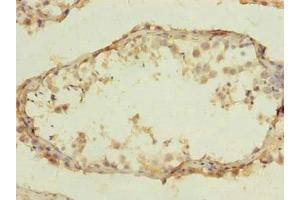 Immunohistochemistry of paraffin-embedded human testis tissue using  at dilution of 1:100 (CLEC4C 抗体  (AA 45-213))