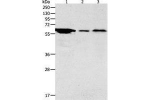 Western Blotting (WB) image for anti-Adenylate Cyclase Activating Polypeptide 1 (Pituitary) Receptor Type I (ADCYAP1R1) antibody (ABIN1870813) (ADCYAP1R1 抗体)