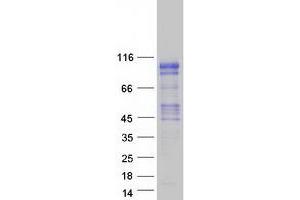 Western Blotting (WB) image for Kazrin (KAZ) (Transcript Variant E) protein (Myc-DYKDDDDK Tag) (ABIN2723996)