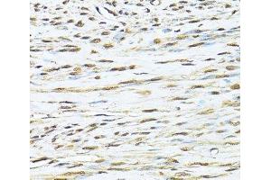 Immunohistochemistry of paraffin-embedded Human uterus using KU70 Polyclonal Antibody at dilution of 1:100 (40x lens). (XRCC6 抗体)