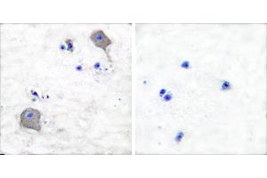 Peptide - +Immunohistochemical analysis of paraffin-embedded human brain tissue using Claudin 5 antibody (#C0145). (Claudin 5 抗体)