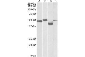 Staining of Mouse Brain (lane A), Rat Brain (lane B), Mouse Thymus (lane C) and Rat Thymus (lane D) lysates  using MEIS2 antibody at 0. (MEIS2 抗体  (Internal Region))