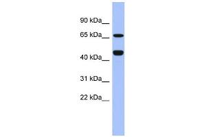 WB Suggested Anti-ZNF713 Antibody Titration:  0. (ZNF713 抗体  (Middle Region))