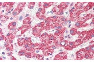 Detection of HAO1 in Human Liver Tissue using Polyclonal Antibody to Hydroxyacid Oxidase 1 (HAO1) (HAO1 抗体  (AA 113-369))