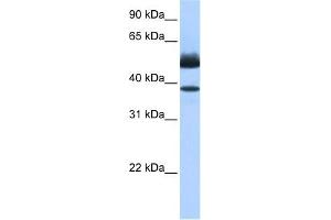 Lipase J antibody used at 0. (LIPJ 抗体  (C-Term))