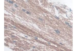 Detection of GLP1R in Mouse Cerebrum Tissue using Polyclonal Antibody to Glucagon Like Peptide 1 Receptor (GLP1R) (GLP1R 抗体  (AA 25-145))