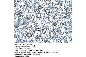 Human Lung (HOXB9 抗体  (N-Term))