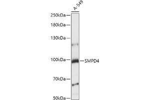 SMPD4 抗体  (AA 600-800)