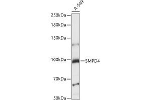 Western blot analysis of extracts of A-549 cells, using SMPD4 antibody (ABIN7270531) at 1:1000 dilution. (SMPD4 抗体  (AA 600-800))
