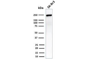 Western Blot Analysis of SK-Br3 cell lysate using CHD4 Mouse Monoclonal Antibody (3F2/4). (CHD4 抗体  (C-Term))