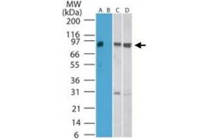 Western blot analysis of SKIL in human kidney lysate in the A) absence and B) presence of immunizing peptide, C) mouse kidney, and D) rat kidney lysate. (SKIL 抗体  (AA 600-684))