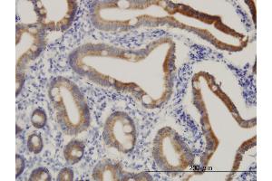 Immunoperoxidase of monoclonal antibody to CPS1 on formalin-fixed paraffin-embedded human small Intestine. (CPS1 抗体  (AA 1400-1500))