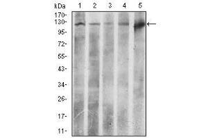 Image no. 4 for anti-ATP Citrate Lyase (ACLY) antibody (ABIN1491378) (ACLY 抗体)