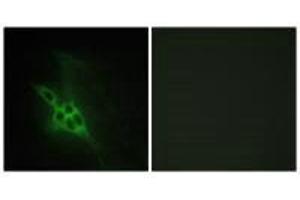 Immunofluorescence analysis of NIH/3T3 cells, using EPHB1/2/3 antibody. (EPH Receptor B1 抗体)