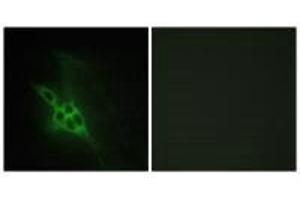 Immunofluorescence analysis of NIH/3T3 cells, using EPHB1/2/3 antibody. (EPHB1/EPHB2/EPHB3 抗体)