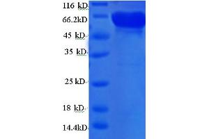 SDS-PAGE (SDS) image for TRA3 (AA 1-480), (full length) protein (His-SUMO Tag) (ABIN5710808) (TRA3 (AA 1-480), (full length) protein (His-SUMO Tag))