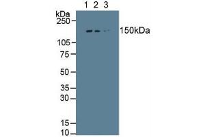 Western Blotting (WB) image for Collagen, Type I, alpha 1 (COL1A1) ELISA Kit (ABIN6730967)