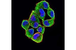 Immunofluorescence analysis of Hela cells using CDKN2A/P16 mouse mAb (green). (Tumor Suppressor ARF (CDKN2A) (AA 1-156) 抗体)