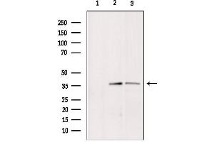 Western blot analysis of extracts from various samples, using BNIP2 Antibody. (BNIP2 抗体  (Internal Region))